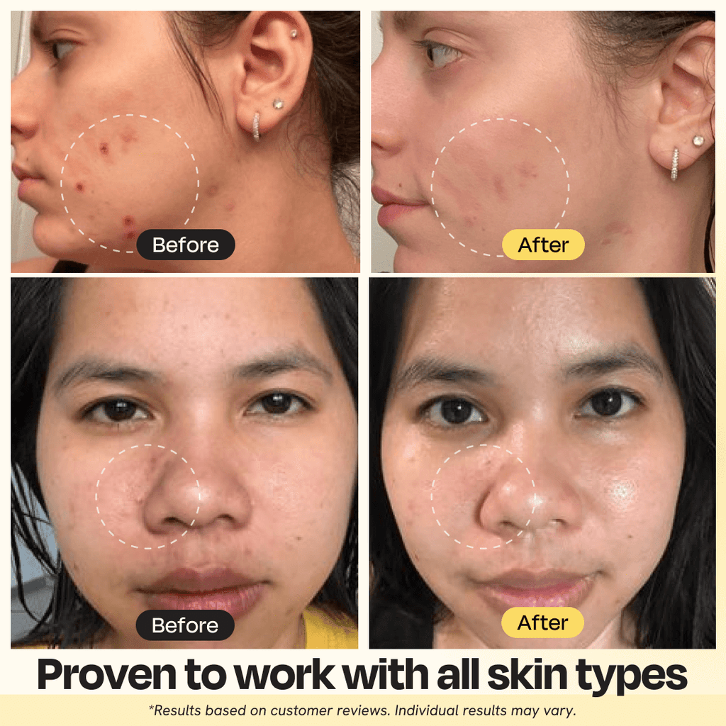 Vitamin C Clay Mask - The Uplift Shop
