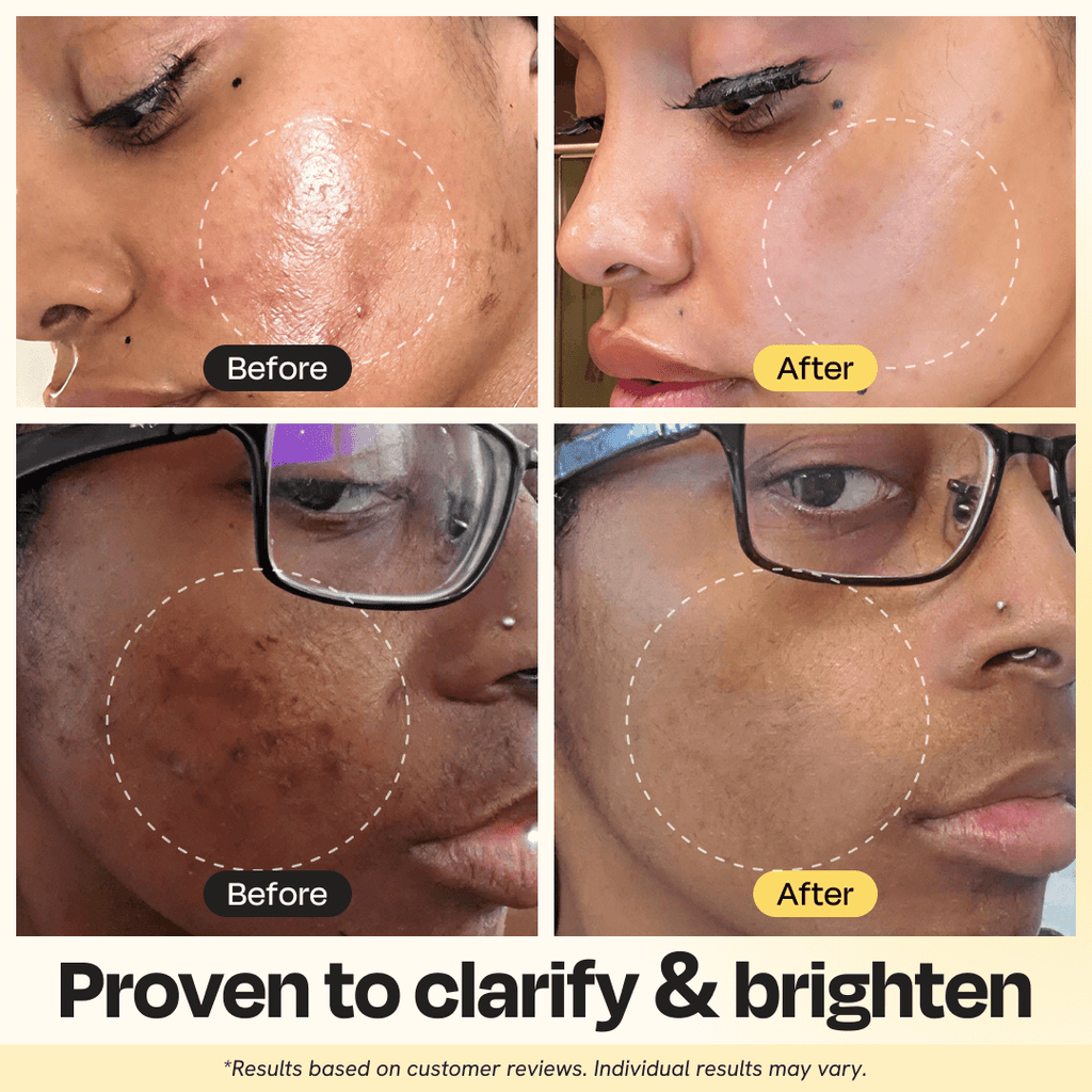 Vitamin C Clay Mask - The Uplift Shop